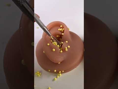 ASMR Earwax cleaning  #asmr #satisfying #asmrvideos