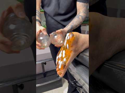 Deep Healing Foot Cupping Therapy#shorts #trending #viral #youtubeshorts