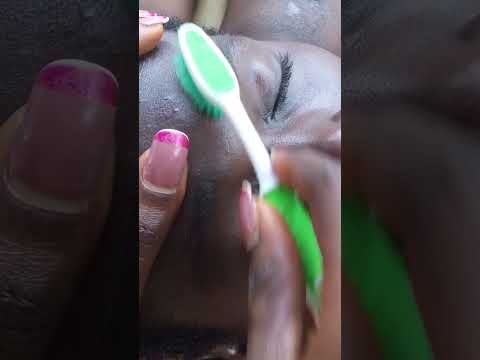 Full face Nitpicking Asmr #satisfying #asmrscratching #tingling #tinglyfeeling #asmrsounds