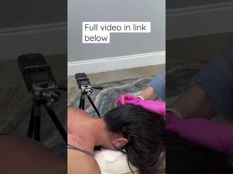 She Felt so Much Relief from this Soothing #chiropractor #asmr