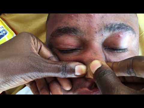 A Good Time To Walk Calm Things| Bests Face Nitpicking #asmr #satisfying #oddlysatisfying