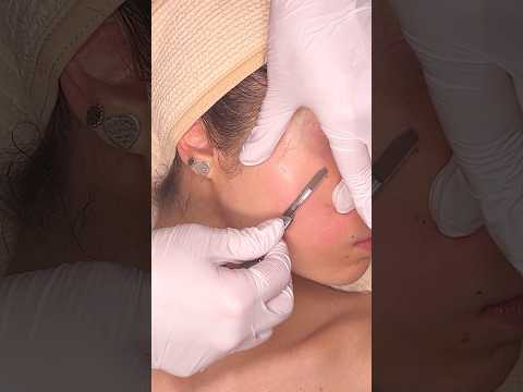 ASMR Dermaplaning Facial