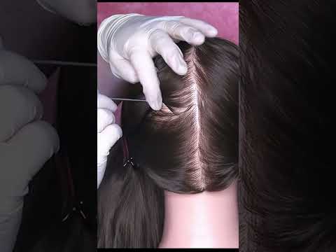 ASMR Scalp Check with Bad Results #shorts