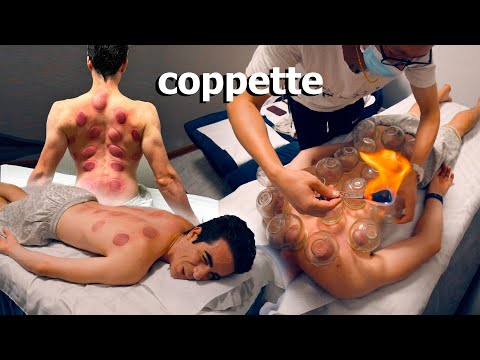 ASMR: MASSAGGIO TUINA RIGENERANTE con COPPETTAZIONE CINESE col Fuoco!