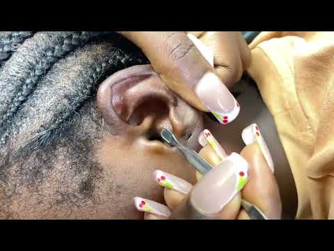 1 Hour Ultimate Ear Cleaning ASMR Compilation for Deep Relaxation and Sleep