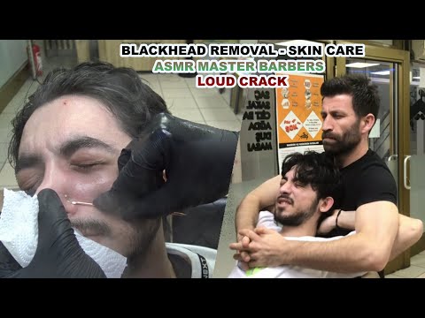 ASMR MASTER BARBERS 💈 BLACKHEAD REMOVAL SKIN CARE 💈 LOUD CRACK 💈 head,face,arm,palm,back,ear massage