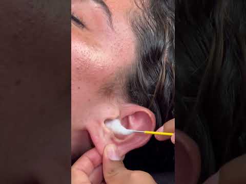 ASMR:  Ear Cleaning and Earwax Removal at home! #shorts #earcleaning