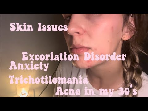 Healing Diaries: Dealing with Trich/acne/anxiety ASMR DIARY  #deardiary #hairpicking #skinpicking