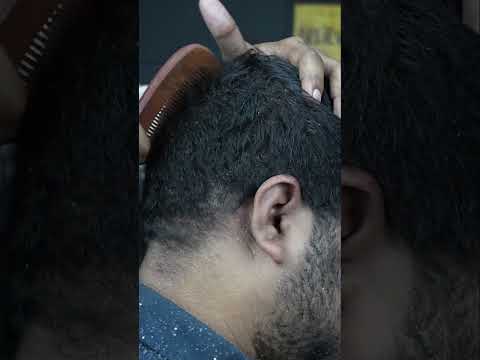Satisfying Dandruff Removal ASMR #shorts