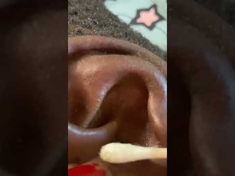 ASMR NITPICKING GUM SMACKING EAR CLEANING #asmr #asmrvideos #satisfying