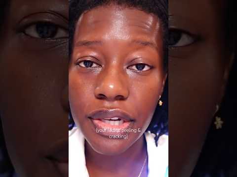ASMR YOUR FACE IS PEELING & CRACKING 😲 #asmrshorts #asmrroleplay #asmrpersonalattention