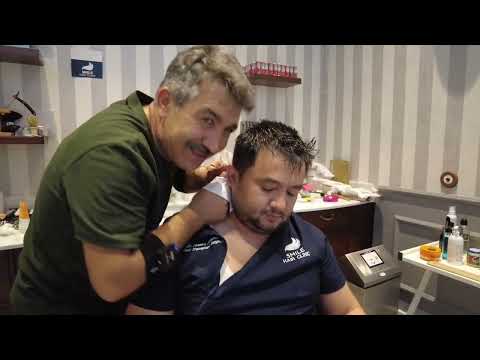 DOCTOR PRE-SURGERY RELAXING MASSAGE HAIR TRANSPLANT SURGEON DR.FIRDAVS AHMEDOV @SmileHairClinic