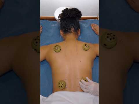 ASMR: Chinese-Thai Acupuncture, Moxibustion, Cupping & Hammer Massage #shorts