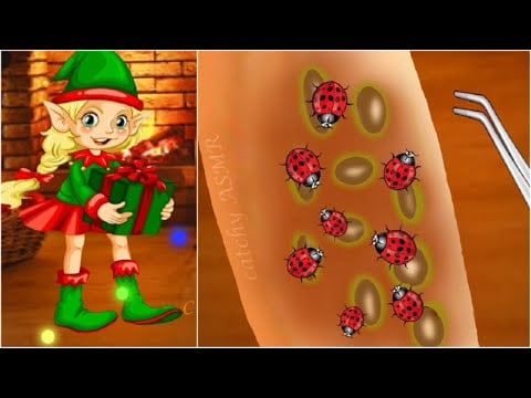 Christmas elf animation ASMR  || Lady bug allergic reaction to sensitive skin