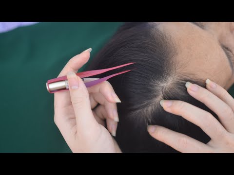 ASMR Scalp Scratching, Hair Parting, Hair Play With Tweezers, Sounds For Therapy ( Tingly )