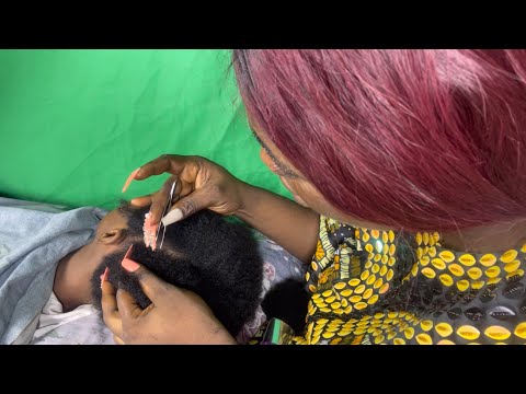 ASMR✨ATTENTIVE SCALP NITPICKING, SOFT WHISPER AND GUM CRACKING SOUND.