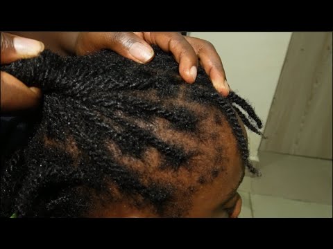 ASMR Intense Scalp Massage, Scratching & Gum chewing for sleep