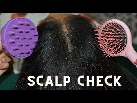 ASMR Scalp Check, Scalp Massage ( Hair Check. Hair Massage ) Help Dry Flakes Treatment Relaxing