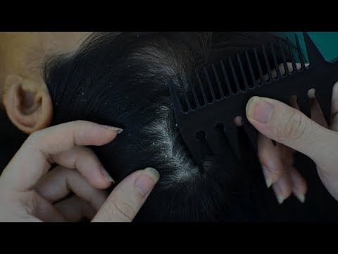ASMR Scalp Check, Scalp Scratching, Hair Parting For Relaxation ( No Talking Asmr )