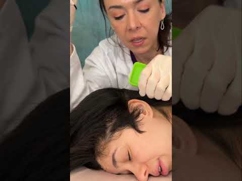 Asmr scalp tingles #asmr #asmrsounds #asmrvideo #relax #relaxing #satisfying #hair #sleep #tingles