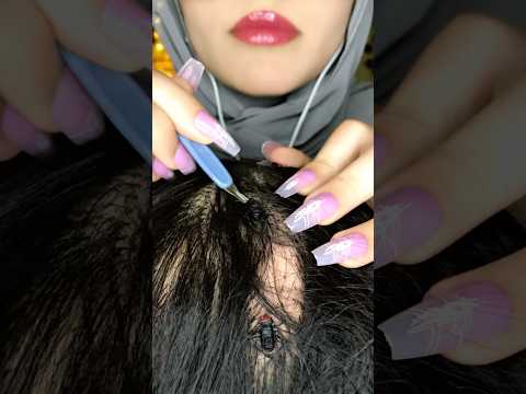 Bugs in your head😥🐜💆🏻‍♀️#asmr #satisfying #asmrmassage #canada #shorts #asmrscratching #relaxing