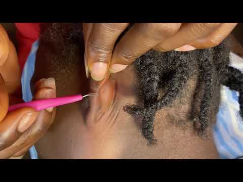 ASMR SATISFYING EAR CLEANING, SCALP SCRATCHING, EAR MASSAGE WITH GUM CHEWING