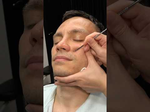 SKIN CARE AND REMOVAL FOR TIMUR #skincare #asmracmp #massage #acneremoval #asmrcare #ciltbakımı