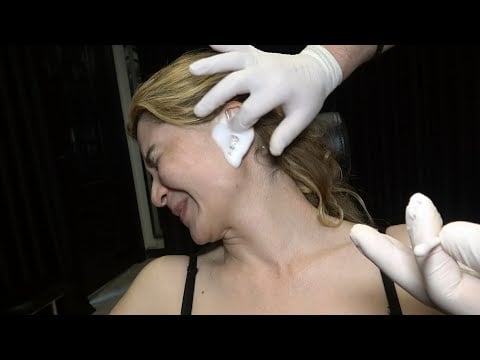 TICKLISH ASMR EAR AND SKIN REMOVAL FOR LADY RANO & SKIN CARE + AND THE HER FACE BECAME LIKE A BABY