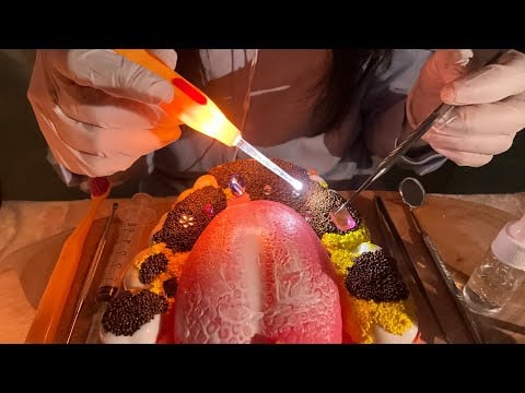 치과 ASMR🦷 극한의 치석 제거 팅글 롤플레이 Dental Cleaning