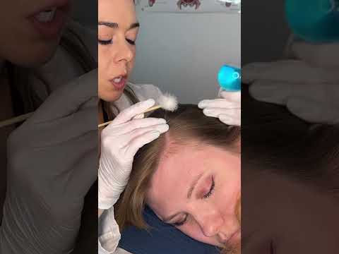 Asmr scalp 💆🏻‍♀️ #asmr #asmrsounds #asmrvideo #relax #relaxing #satisfying #hair #sleep #tingles