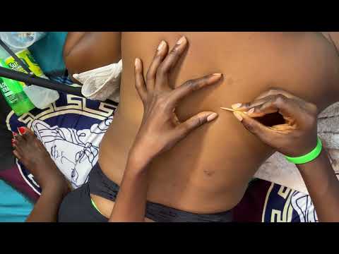 ASMR BACK MASSAGE SCRATCHING AND NITPICKING  FOR  RELAXING SLEEP WITH GUM CHEWING