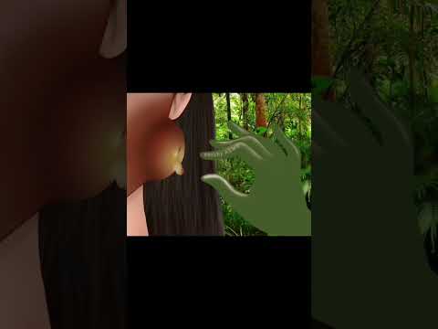 Pus removal animation||#asmranimation #stopmotionanimation #pusremoval #treatmentanimation