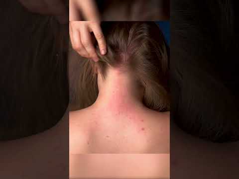 Instant ASMR: Rapid Scalp & Skin Tracing #shorts #asmr