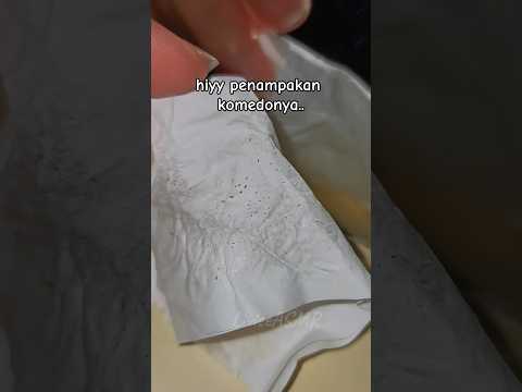 ASMR Cabut Komedo with Breylee Tea Tree Step 1 and Step 2 #asmr #breylee #komedo