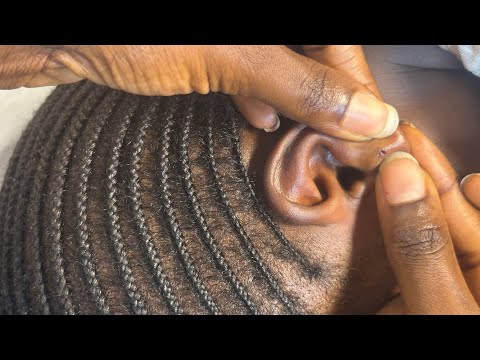 ASMR EAR CLEANING FOR THOSE WHO NEED SLEEP IMMEDIATELY WITH GUM CHEWING