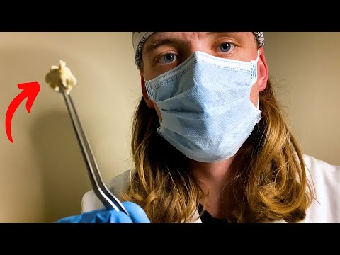 ASMR Professional Earwax Removal [Doctor Roleplay]