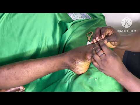Asmr✨leg and feet massage, toe nail cutting with gum cracking