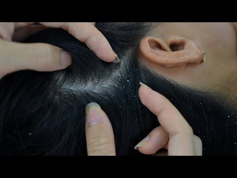 ASMR Scalp Check, Nape Check ( Scratching, Massage ) Relaxing For Sleep / No Talking