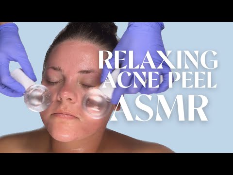 FACE REALITY ACNE PEEL ASMR