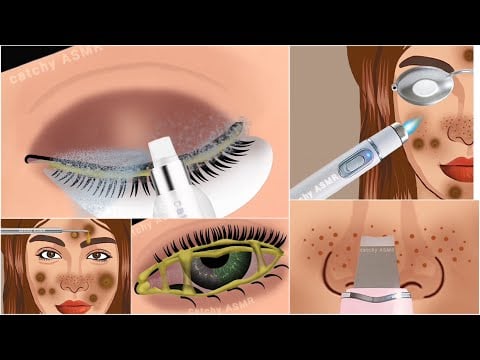 ASMR care animation collection 1 || eye cleaning || face skin care ASMR ||