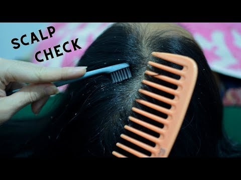 ASMR Scalp Check With Toothbrush / Dandruff Removal / Dandruff Scratching Relax For Sleep