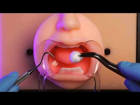 【ASMR】最強歯科医による🦷口内治療ロールプレイ (字幕, スッキリ)