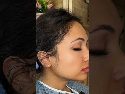 Asmr ear 👂 exam #asmr #relax #relaxing #asmrsounds #asmrvideo #tingles #medical #satisfying #sleep