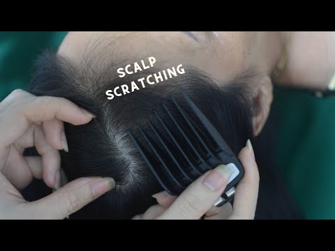 ASMR Scalp Scratching Fast And Aggressive, Scalp Massage Real Person For Headache Relief Faster