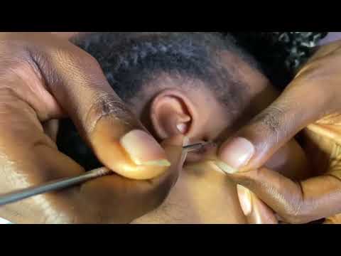 ASMR Ear Cleaning, Back Scratching & Scalp Scratching Compilation for Deep Tingles
