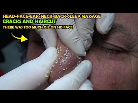 ALMOST 1KG OF OIL CAME OUT OF HIS FACE 💈 EAR BURN 💈 CRACKS 💈HAIRCUT💈 head,face,ear,arm,back massage