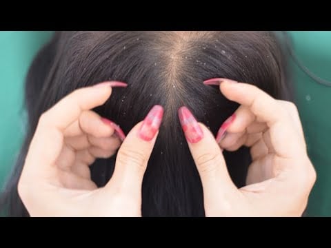 ASMR Scalp Scratching Tingles, Scalp Massage For Relaxation ( No Talking )