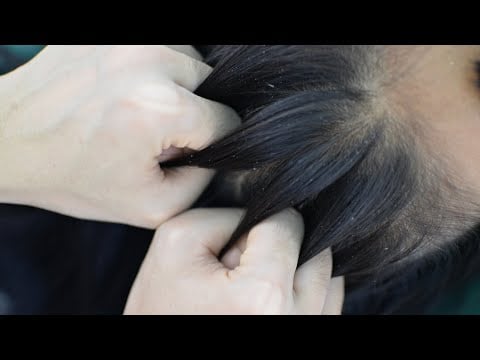 Asmr Scalp Scratching, Hair Scratching, Head Scratching Fast And Aggressive For Relieve Stress