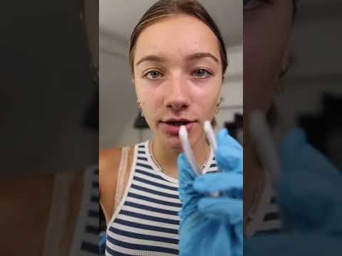 ASMR - FAST DENTAL CHECK-UP! #shorts