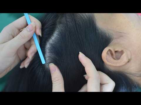 ASMR Tingly Hair Sounds With Hair Parting and Scalp Scratching For Reduce Stress, Anxiety